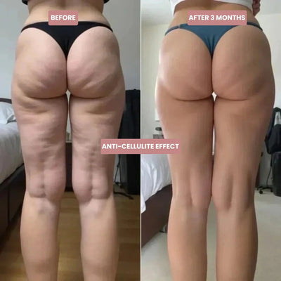 Sculptly Elevate™ Cellulite-Sculpting Leggings