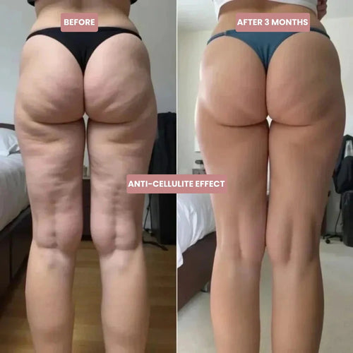 Sculptly Elevate™ Cellulite-Sculpting Leggings