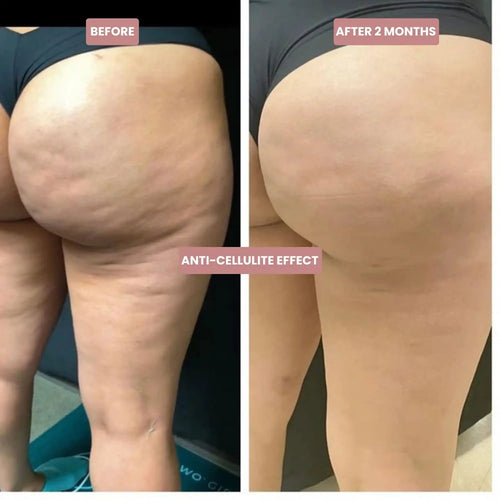Sculptly Elevate™ Cellulite-Sculpting Leggings
